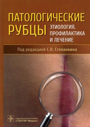 Патологические рубцы. Этиология, профилактика и лечение