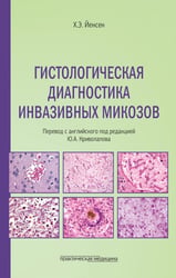 Гистологическая диагностика инвазивных микозов