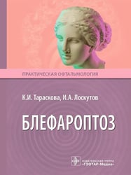 Блефароптоз