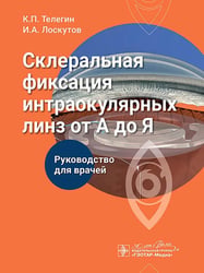 Склеральная фиксация интраокулярных линз от А до Я: руководство для врачей