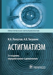 Астигматизм. 2-е изд., перераб. и доп