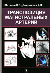 Транспозиция магистральных артерий