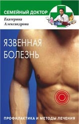Язвенная болезнь Профилактика и методы лечения
