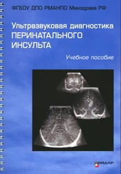 Ультразвуковая диагностика перинатального инсульта: Учебное пособие