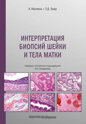 Интерпретация биопсий шейки и тела матки