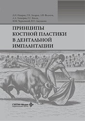 Принципы костной пластики в дентальной имплантации