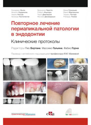 Повторное лечение периапикальной патологии в эндодонтии. Клинические протоколы