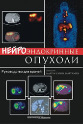 Нейроэндокринные опухоли. Руководство для врачей