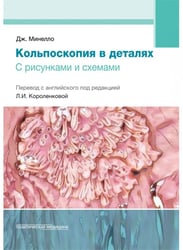 Кольпоскопия в деталях. С рисунками и схемами