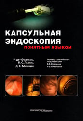 Капсульная эндоскопия понятным языком