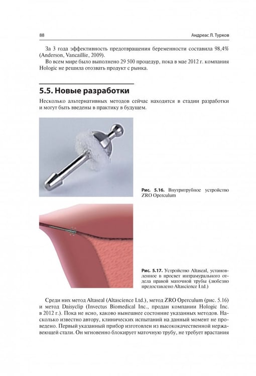 Дополнительное изображение книги «Мини-инвазивная гинекологическая хирургия»