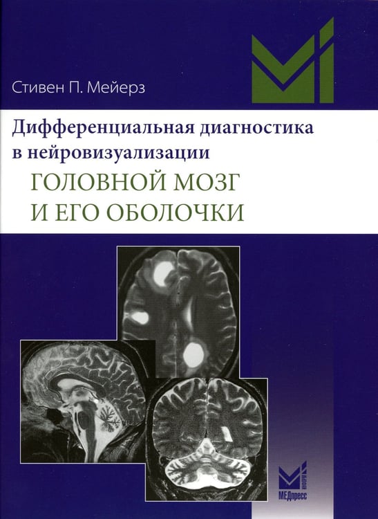 Дополнительное изображение книги «Дифференциальная диагностика в нейровизуализации. Головной мозг и его оболочки»