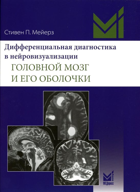 Обложка книги «Дифференциальная диагностика в нейровизуализации. Головной мозг и его оболочки» — Мейерз Стивен П., ISBN 9785907504974