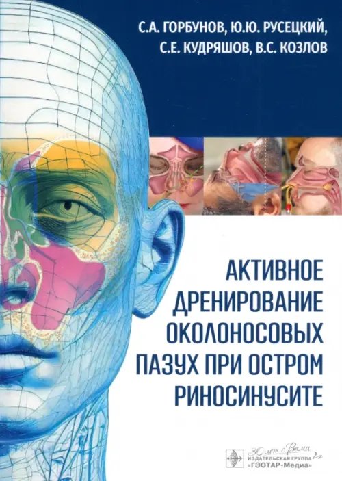 Обложка книги «Активное дренирование околоносовых пазух при остром риносинусите» — Русецкий Юрий Юрьевич, Горбунов Сергей Александрович, Кудряшов Степан Евгеньевич, ISBN 9785970488041