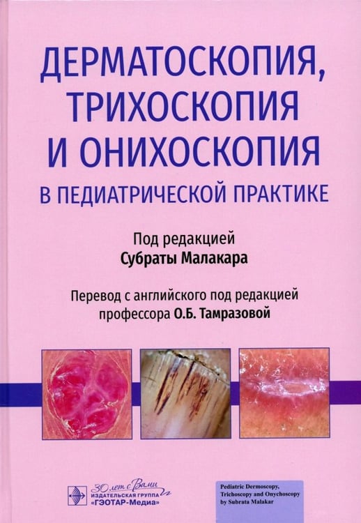 Обложка книги «Дерматоскопия, трихоскопия и онихоскопия в педиатрической практике» — Малакар Субрата, ISBN 9785970481530
