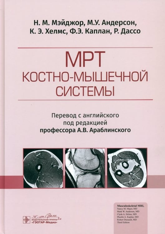 Обложка книги «МРТ костно-мышечной системы» — Андерсон Марк, Мэйджор Нэнси М., Хелмс Клайд, ISBN 9785970470398
