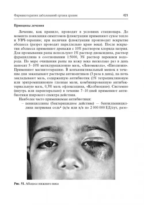 Дополнительное изображение книги «Офтальмофармакология. Руководство для врачей»