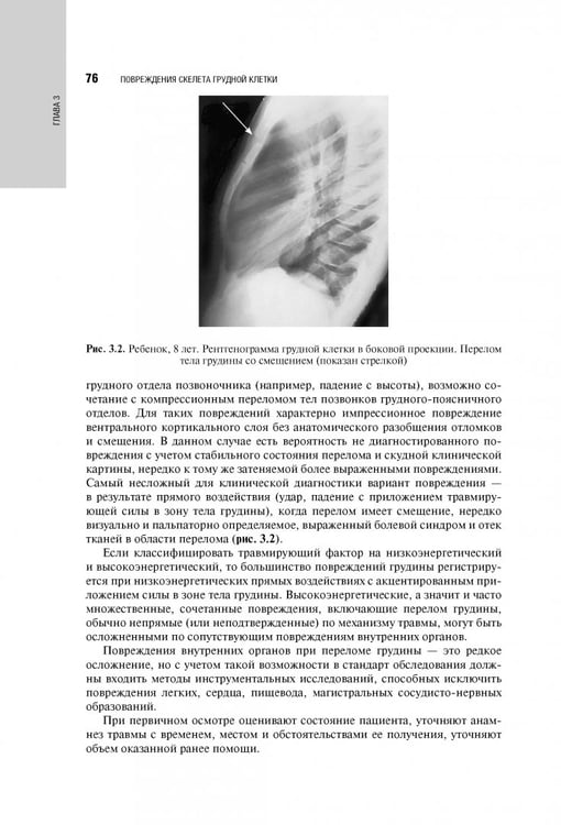 Дополнительное изображение книги «Травматология детского возраста. Национальное руководство»