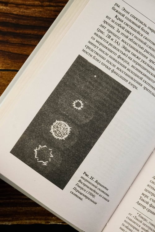 Дополнительное изображение книги «Мигрень»