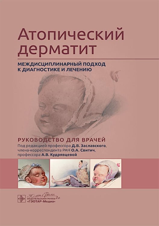 Дополнительное изображение книги «Атопический дерматит. Междисциплинарный подход к диагностике и лечению: руководство для врачей»