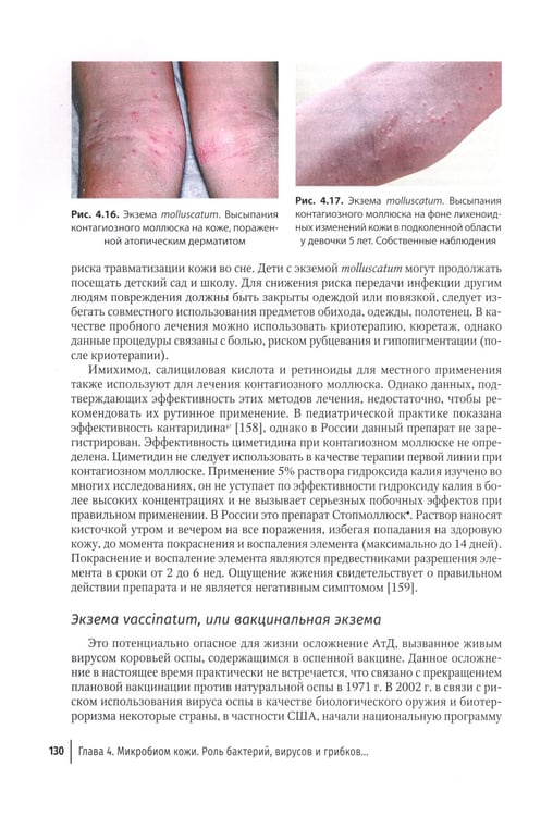 Дополнительное изображение книги «Атопический дерматит. Междисциплинарный подход к диагностике и лечению: руководство для врачей»