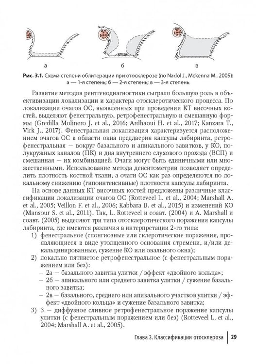 Дополнительное изображение книги «Отосклероз»