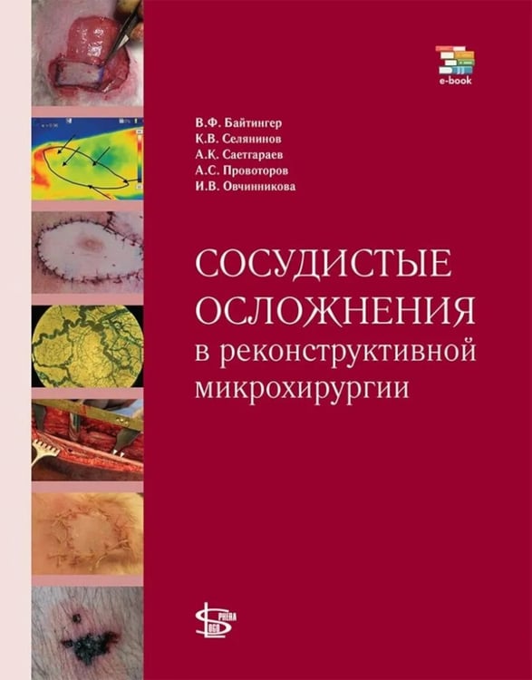 Дополнительное изображение книги «Сосудистые осложнения в реконструктивной микрохирургии»