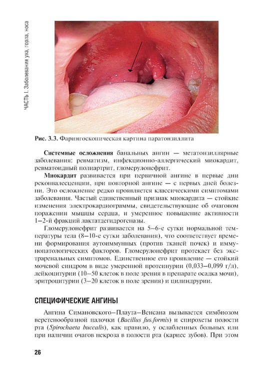 Дополнительное изображение книги «Сестринская помощь при заболеваниях уха, горла, носа, глаза и его придаточного аппарата: учебное пособие»