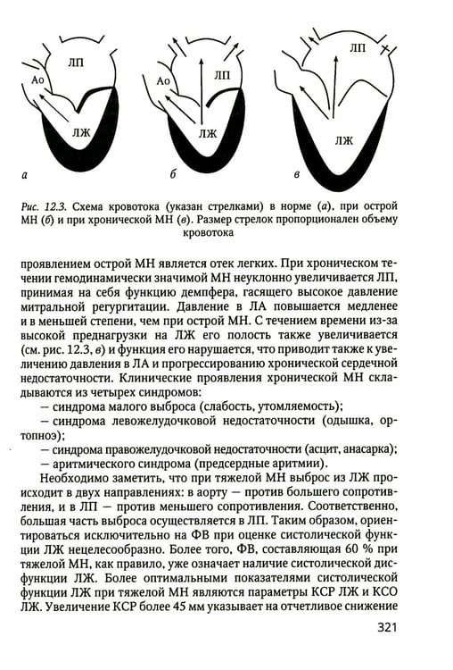 Дополнительное изображение книги «Практикум по клинической эхокардиографии: руководство для врачей»