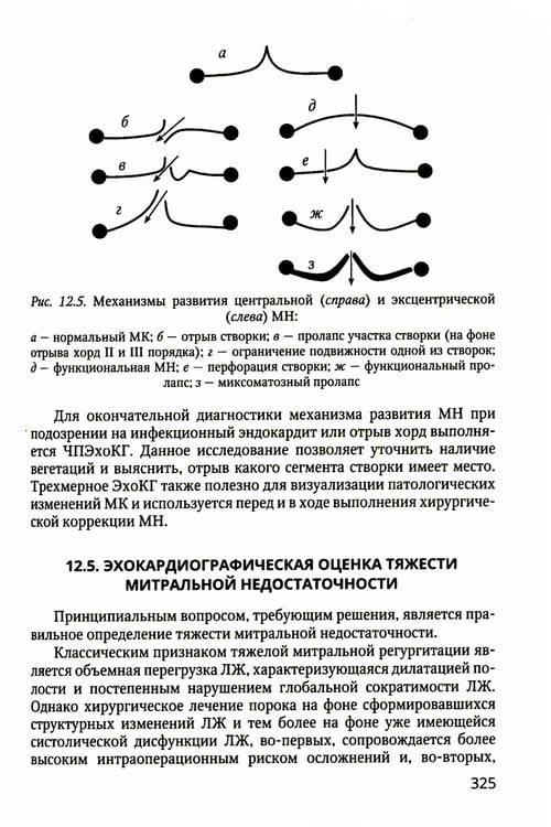 Дополнительное изображение книги «Практикум по клинической эхокардиографии: руководство для врачей»