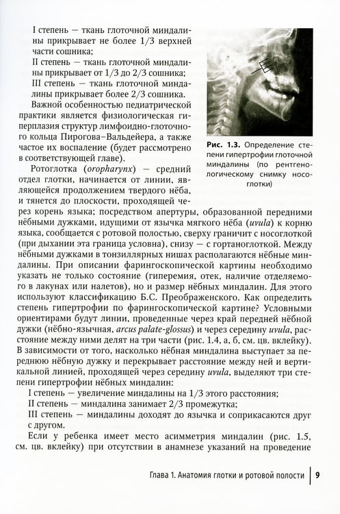 Дополнительное изображение книги «Острый тонзиллофарингит у детей»