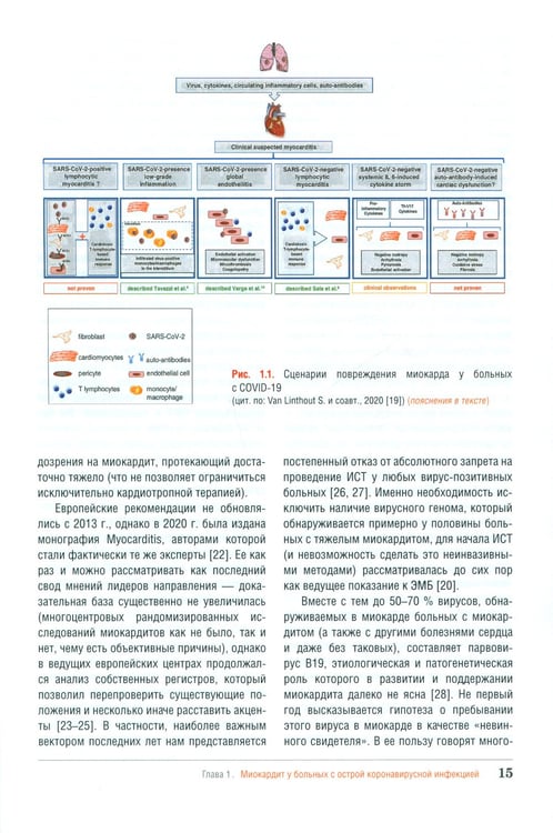 Дополнительное изображение книги «Миокардит в период пандемии SARS-CoV-2»