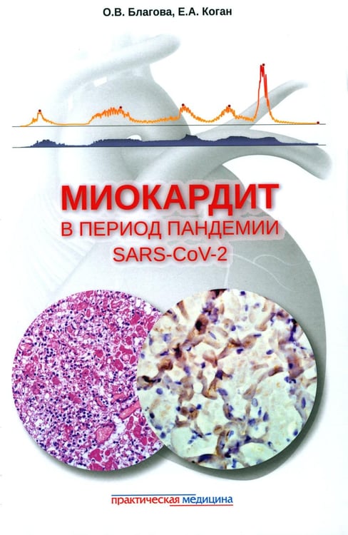 Обложка книги «Миокардит в период пандемии SARS-CoV-2» — Благова Ольга Владимировна;Коган Евгения Алтаровна, ISBN 9785988117278