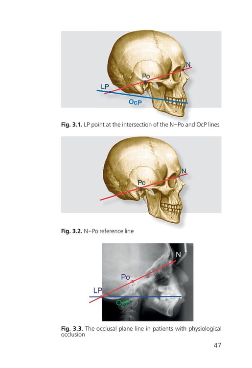 Дополнительное изображение книги «Orthodontics. Modern Methods of Diagnosing Dental Abnormalities, Dentition and Occlusion: tutorial: на англ.яз»