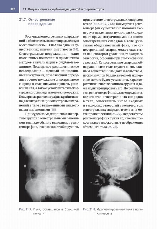 Дополнительное изображение книги «Судебно-медицинская радиология. От идентификации личности до посмертной визуализации»