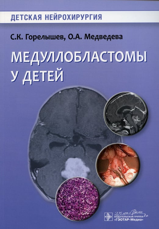 Дополнительное изображение книги «Медуллобластомы у детей»