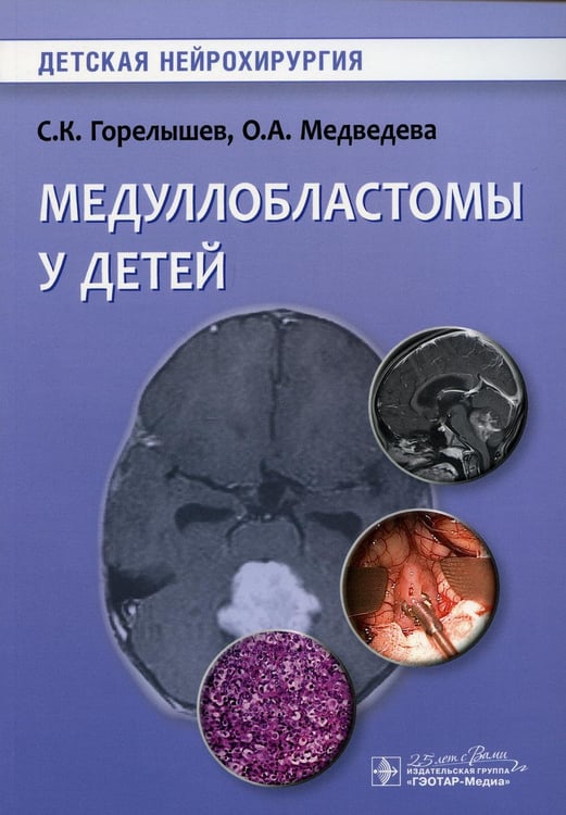 Обложка книги «Медуллобластомы у детей» — Горелышев Сергей Кириллович;Медведева Ольга Александровна, ISBN 9785970454251