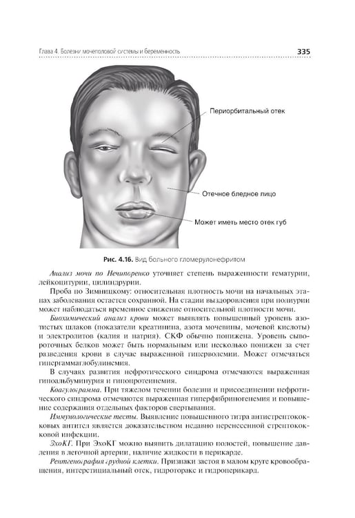Дополнительное изображение книги «Соматические заболевания, отравления и беременность: Учебник»