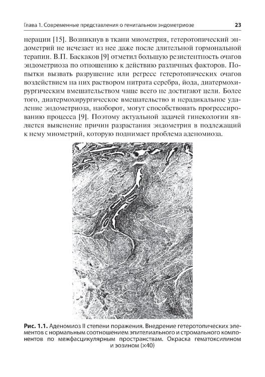 Дополнительное изображение книги «Генитальный эндометриоз. Новый взгляд на старые проблемы»