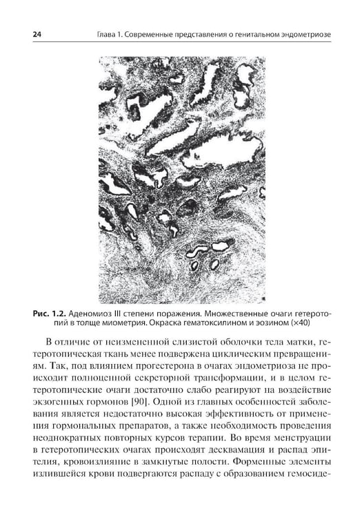 Дополнительное изображение книги «Генитальный эндометриоз. Новый взгляд на старые проблемы»