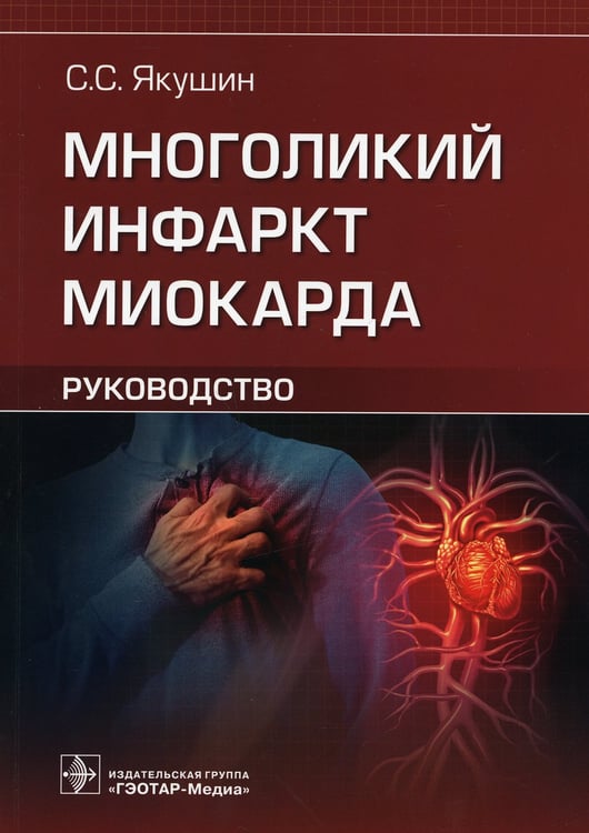 Дополнительное изображение книги «Многоликий инфаркт миокарда. Руководство»