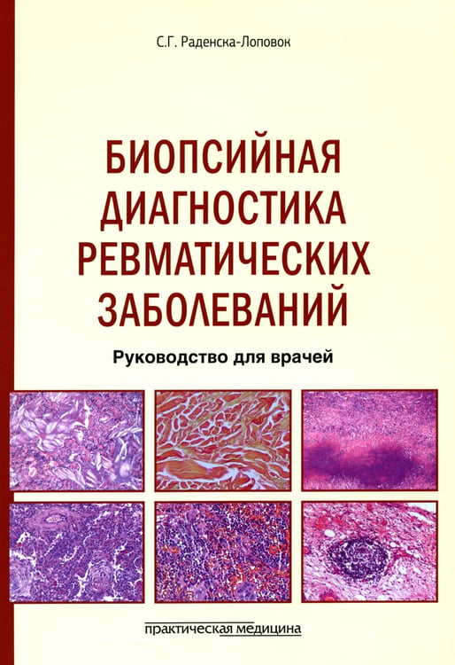 Дополнительное изображение книги «Биопсийная диагностика ревматических заболеваний. Руководство для врачей»