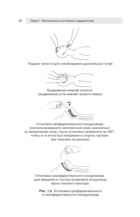 Дополнительное изображение книги «Неотложная медицина: оксфордский справочник»