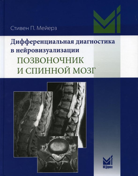 Обложка книги «Дифференциальная диагностика в нейровизуализации. Позвоночник и спинной мозг» — Мейерз Стивен П., ISBN 9785000307397