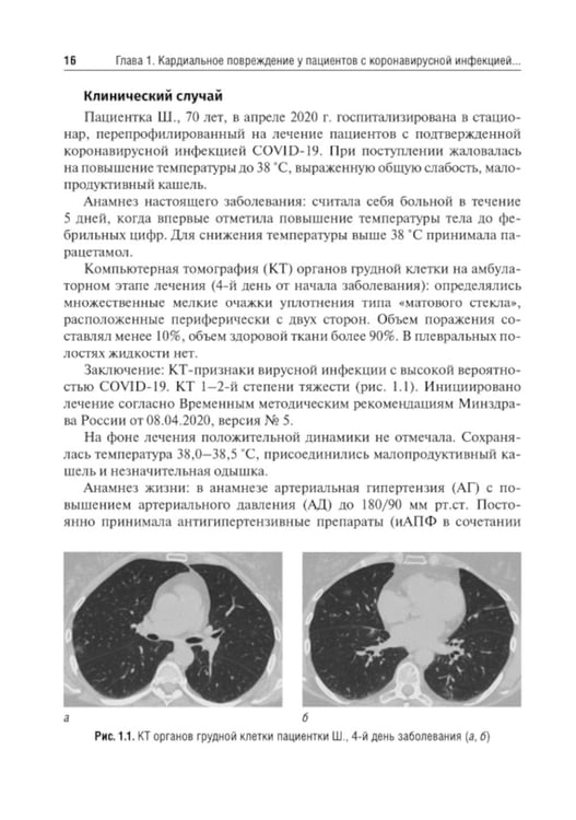 Дополнительное изображение книги «Трудный пациент с COVID-19. Междисциплинарный подход: Учебное пособие»