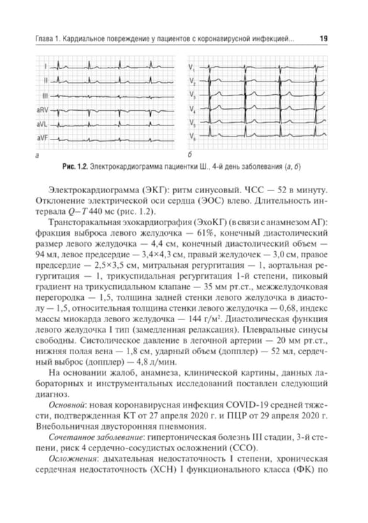 Дополнительное изображение книги «Трудный пациент с COVID-19. Междисциплинарный подход: Учебное пособие»