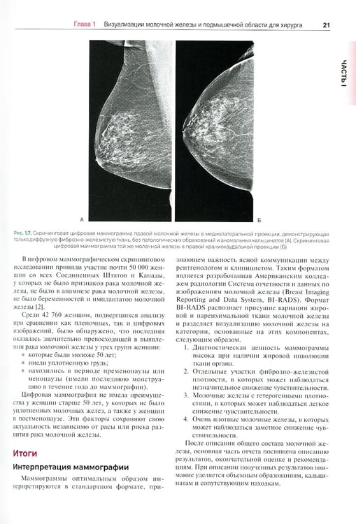 Дополнительное изображение книги «Хирургия молочной железы»