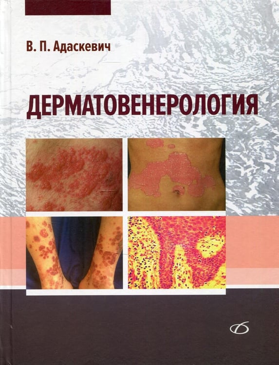 Обложка книги «Дерматовенерология» — Адаскевич Владимир Петрович, ISBN 9785896772064