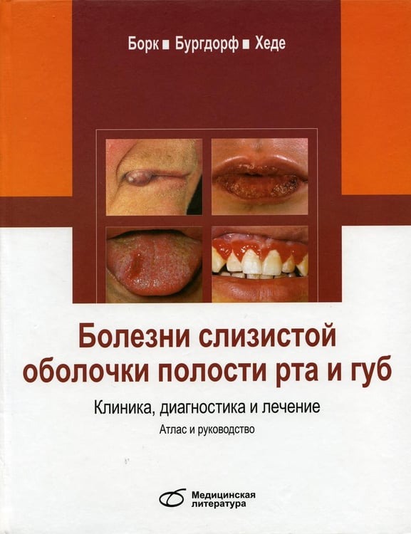 Обложка книги «Болезни слизистой оболочки полости рта и губ. Клиника, диагностика и лечение. Атлас и руководство» — Бургдорф Вальтер;Борк Конрад;Хеде Николаус, ISBN 9785918030059