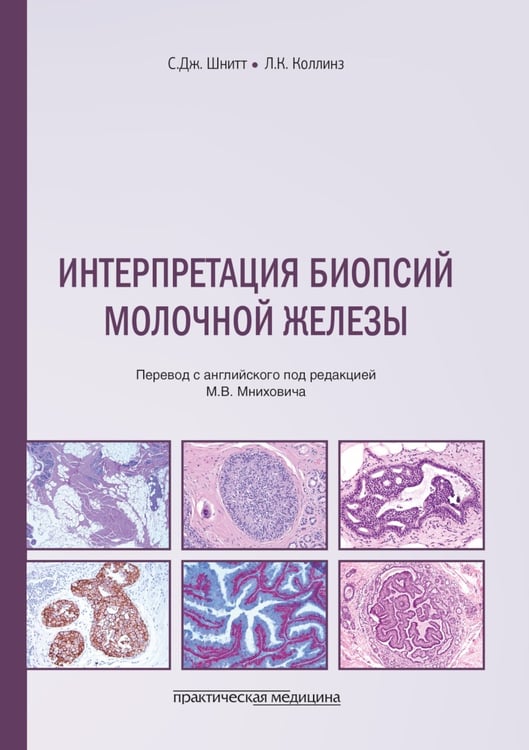 Дополнительное изображение книги «Интерпретация биопсий молочной железы»